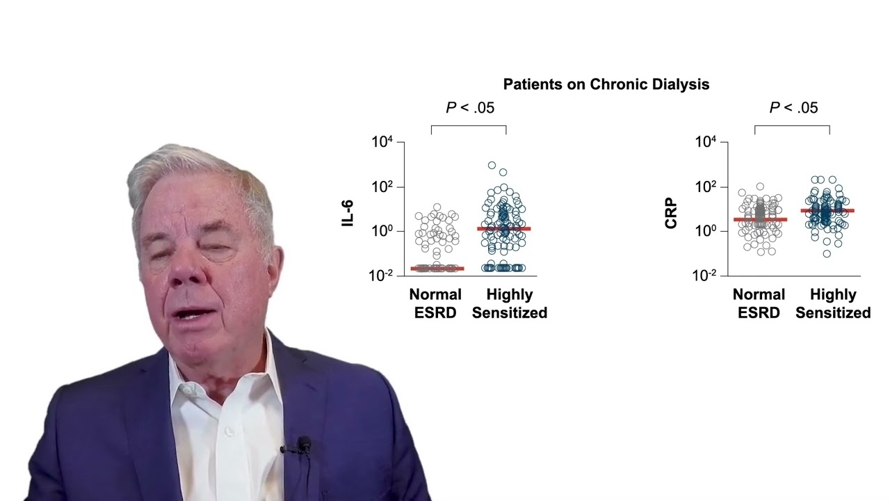 Chronic Active Antibody Mediated Rejection  Targeting IL 6 to Improve Outcomes in Kidney Transplant