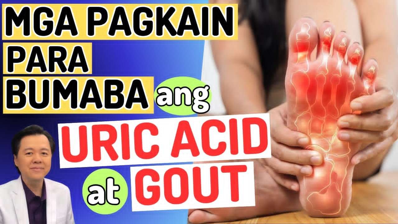 Mga Pagkain Para Bumaba ang Uric Acid at Gout - By Doc Willie Ong (Internist and Cardiologist)