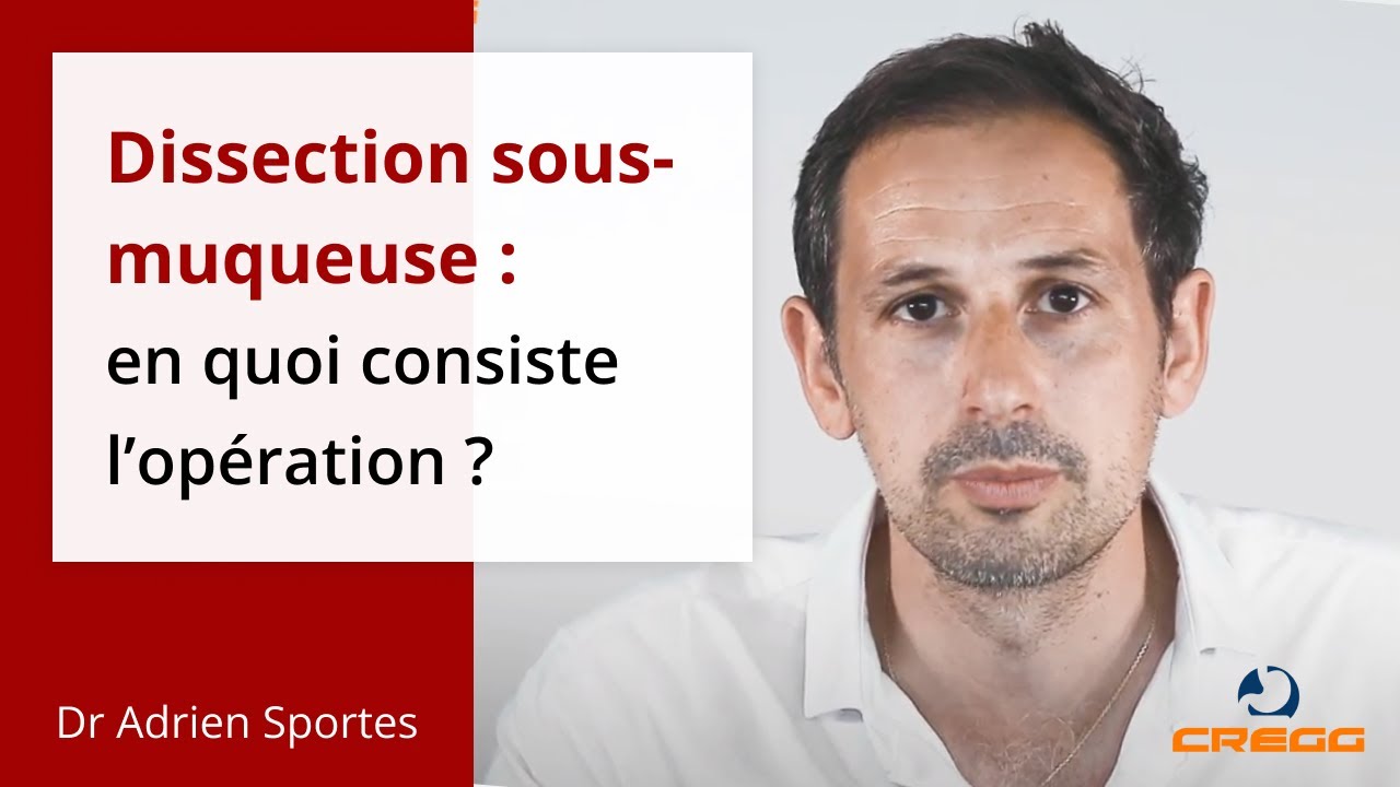 Op&eacute;ration de la dissection sous-muqueuse : c'est quoi ?