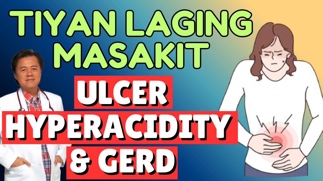 Tiyan Laging Masakit. Ulcer, Hyperacidity & GERD - By Doc Willie Ong (Internist and Cardiologist)