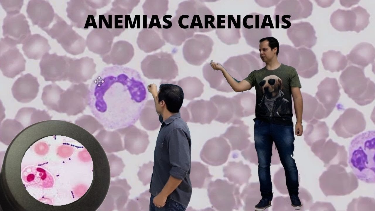 Anemias Carenciais, Aulão completo