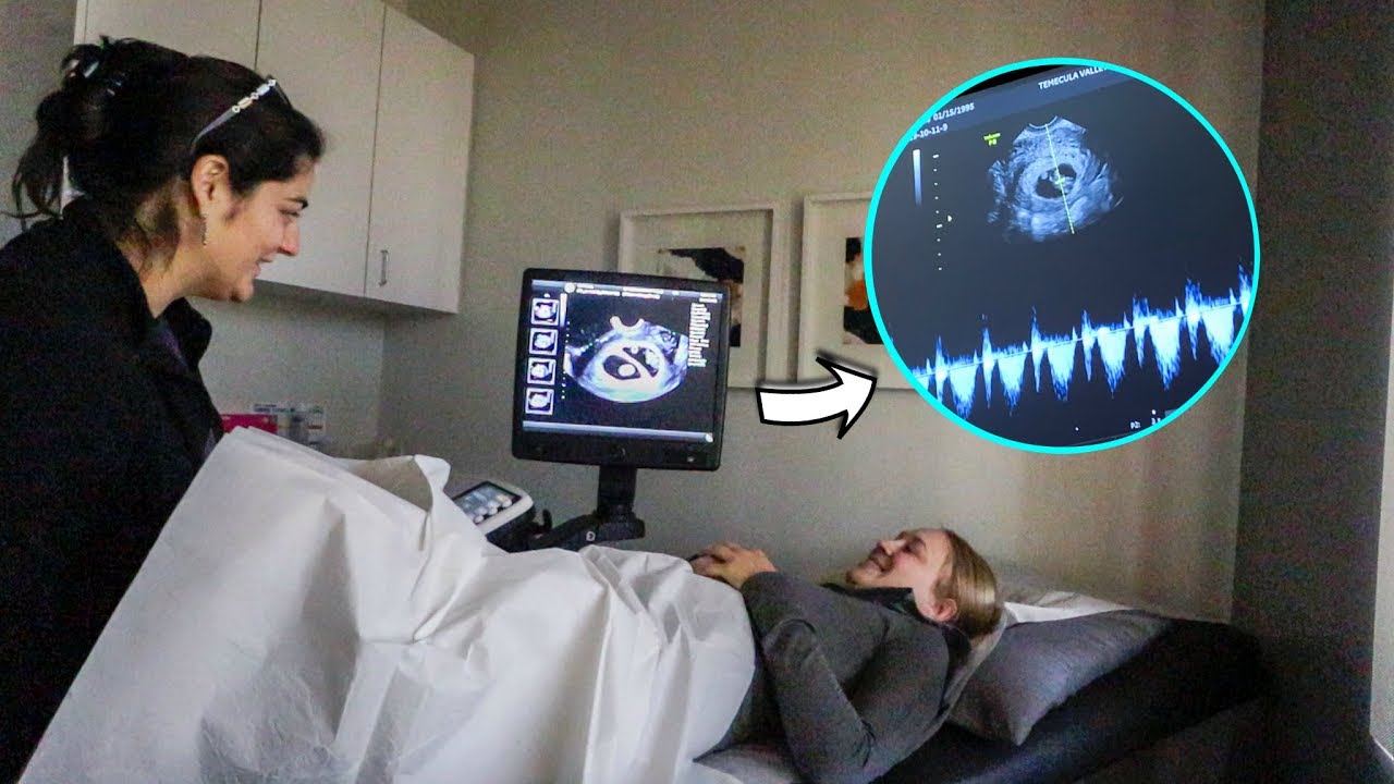 Goodbye Fertility Clinic + Hearing The Twin's Heartbeats!!!