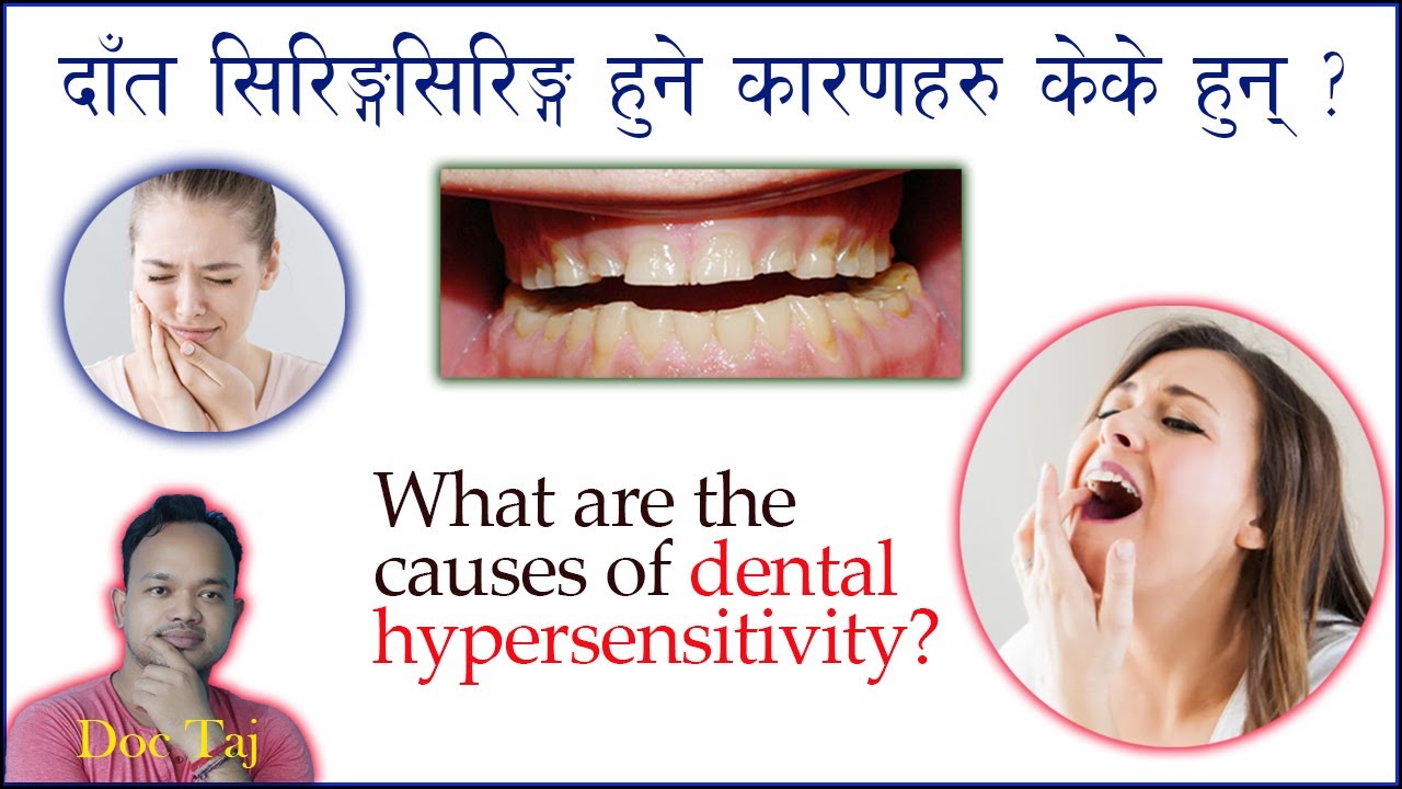 Causes of tooth sensitivity/ दाँत सिरिङ्सिरिङ  हुने कारणहरु/Dentin hypersensitivity/ Doc Taj