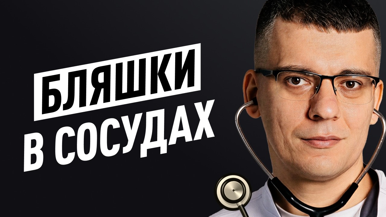 Что скрывают врачи про ХОЛЕСТЕРИН? Статины и атеросклероз. Кардиолог Тамаз Гоглашвили.