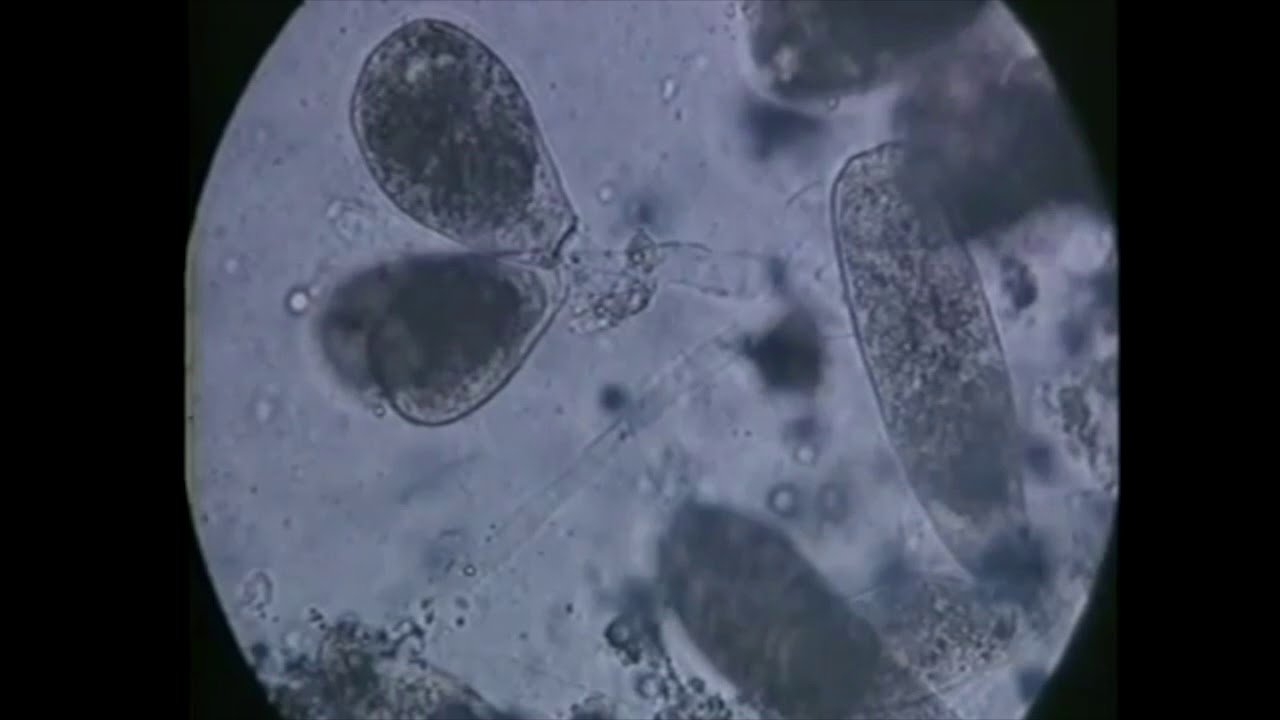 Epistylis - parasite diseases in trout - signs, identification, treatment
