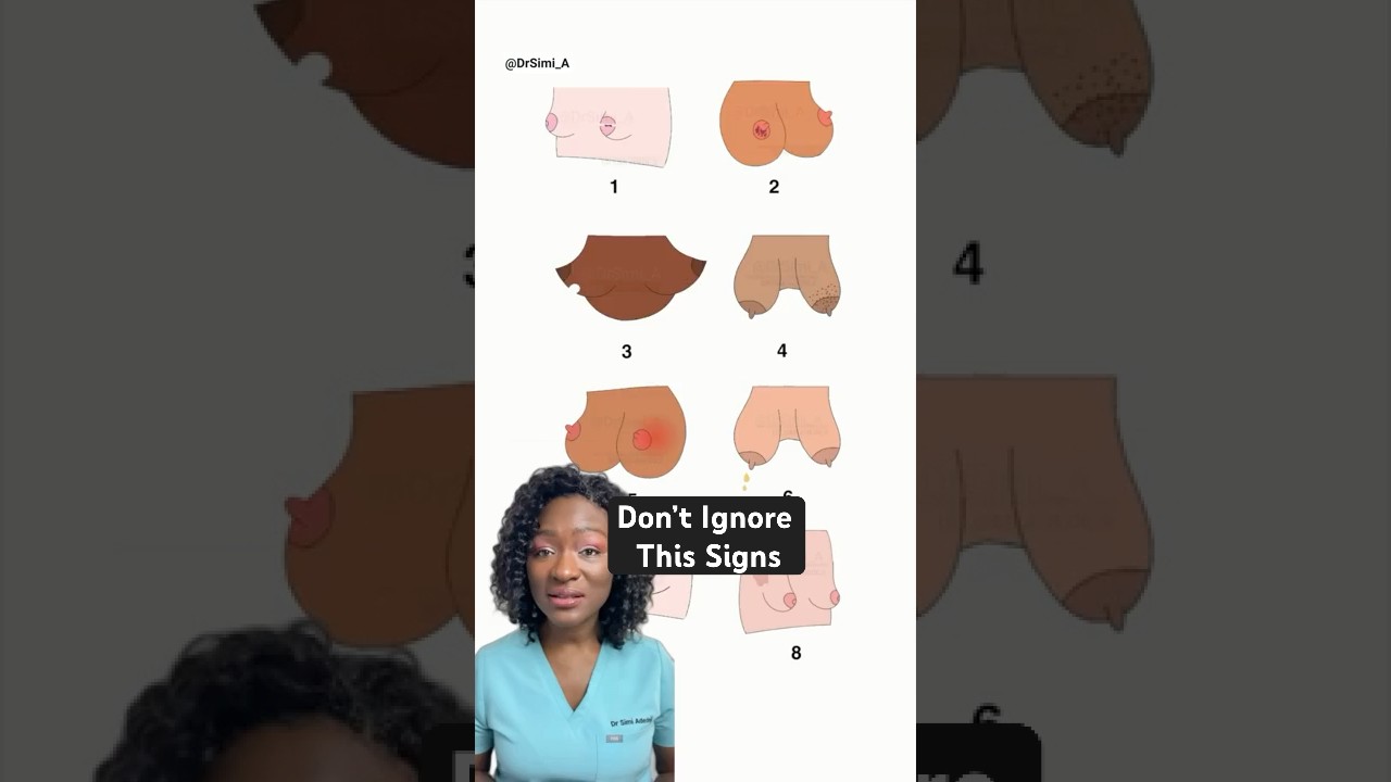 Don't Ignore These 8 Signs On Your Breast
