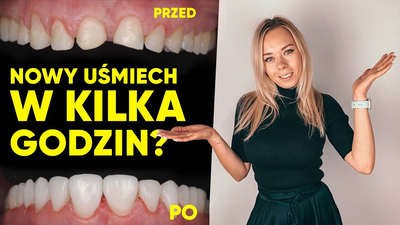 Flow injection - NOWE ZĘBY NA JEDNEJ WIZYCIE?
