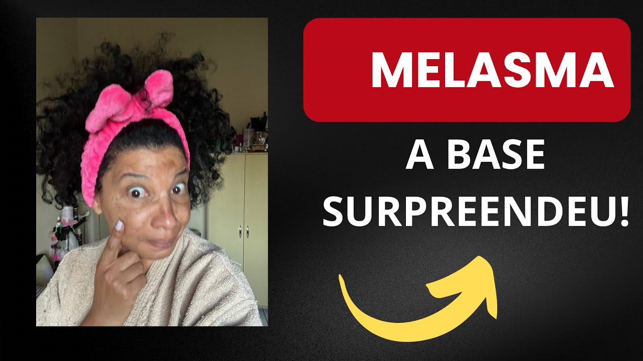 SÉRIE | Parte 3 - Bases Baratas x Melasma: A Verdade na Pele