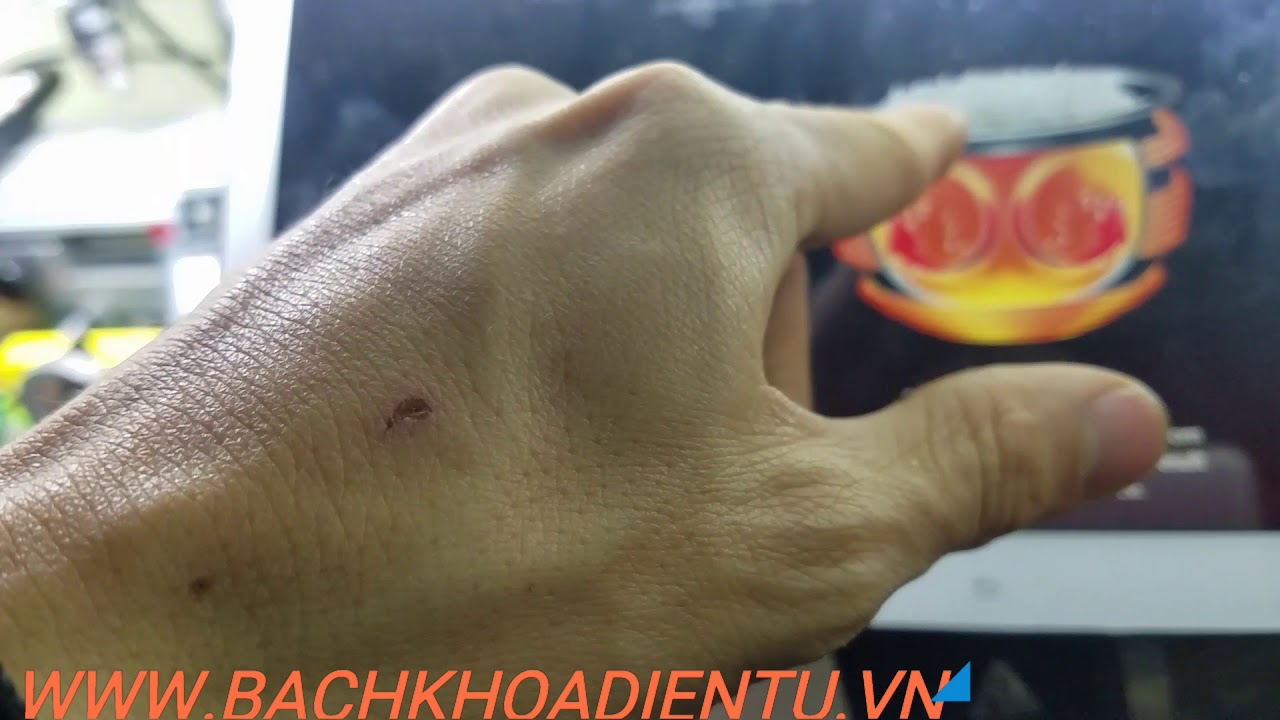 Xử Lý Nồi Cơm Điện Tử Bị Thiu Cơm, Chảy Mồ Hôi Vung
