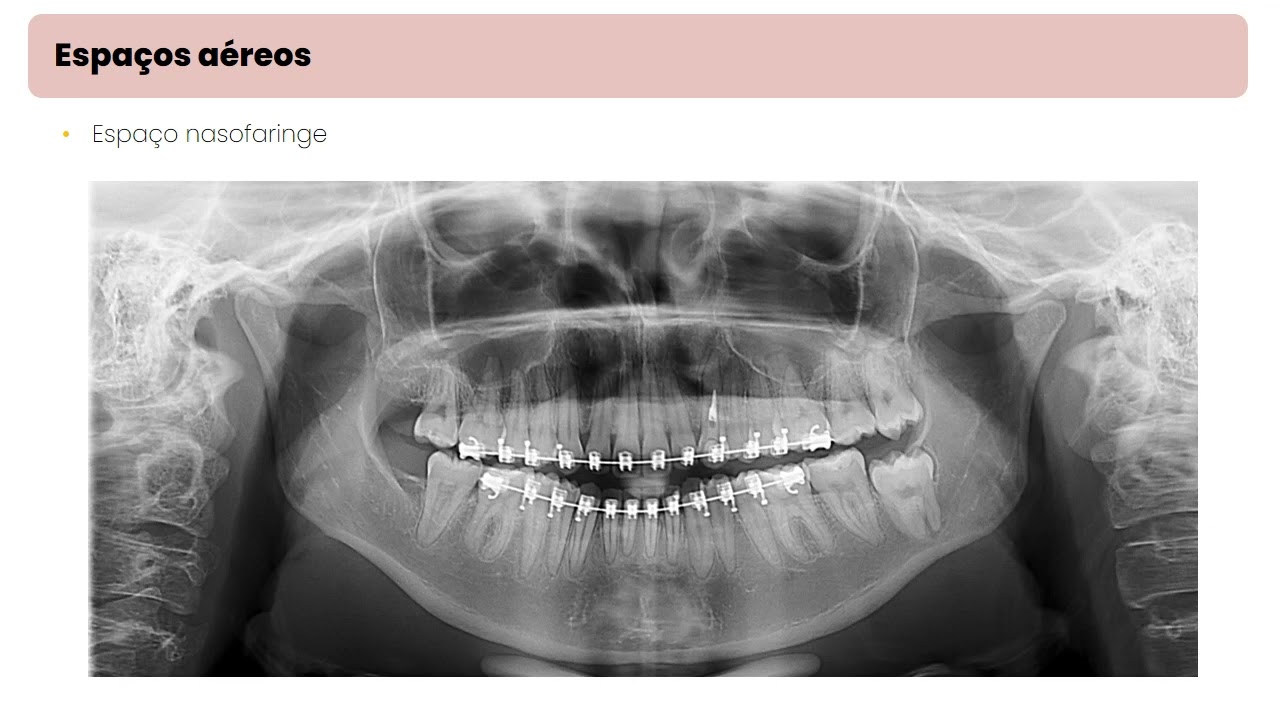 Anatomia Panorâmica - PARTE 3