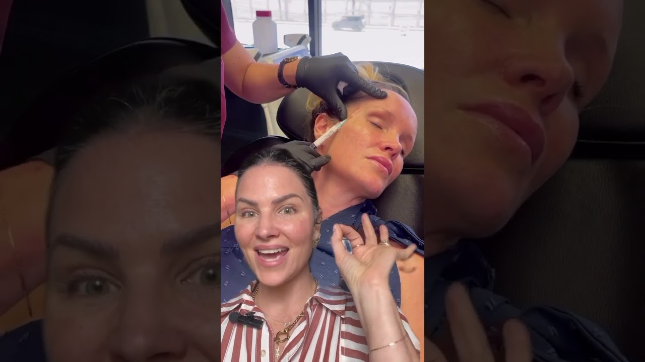 Watch Temple Filler Transform Her Face #injectables #dermalfillers #facialaesthetics