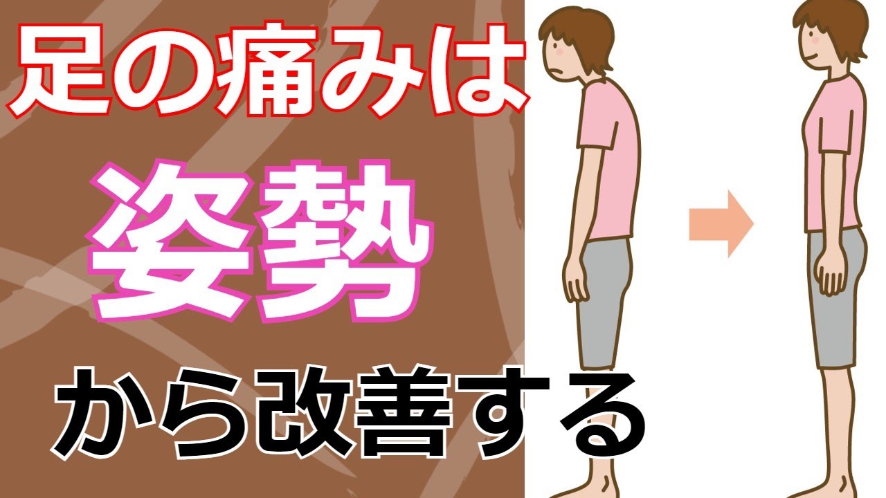 足の痛み（足底腱膜炎、モートン病）のしびれは姿勢から根本改善する｜足の悩み解消専門チャンネル