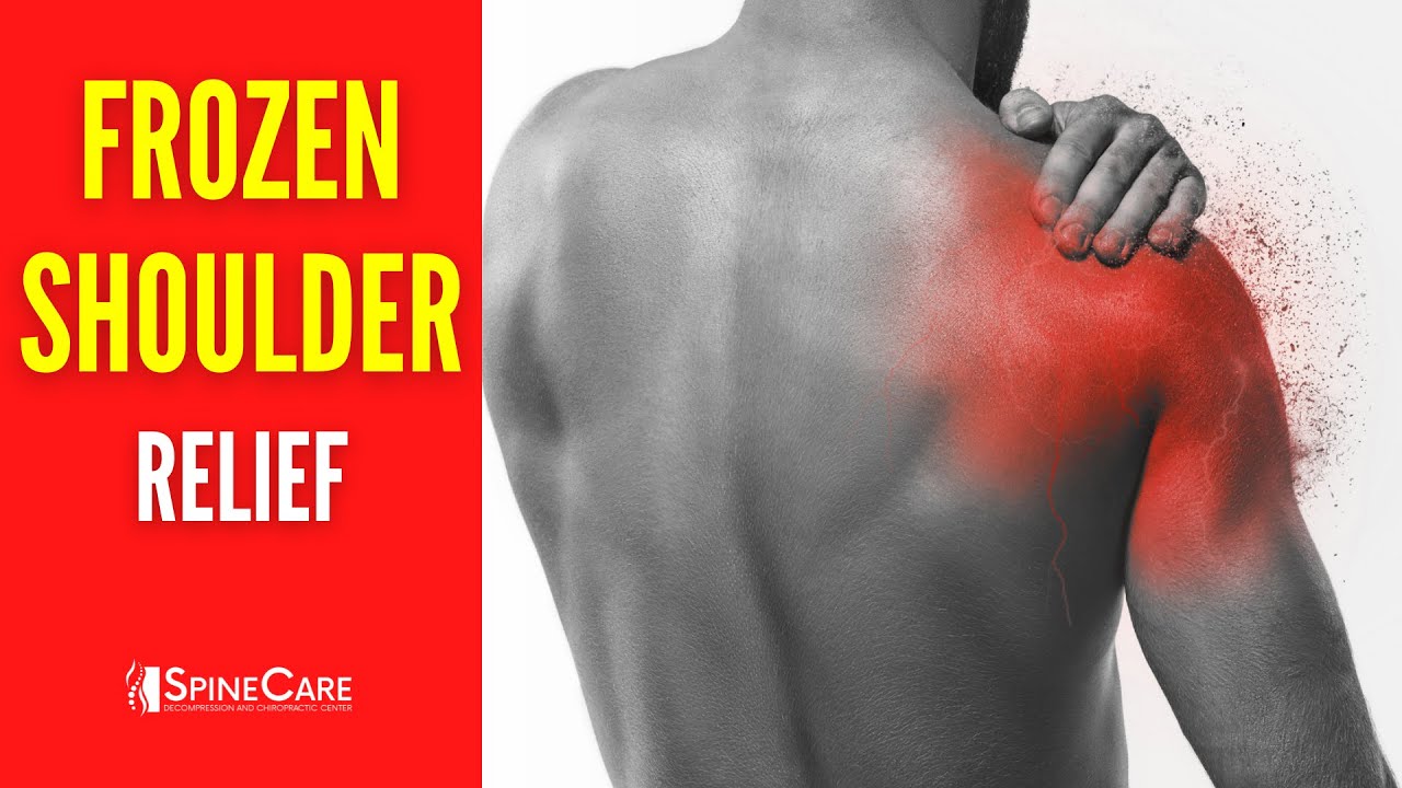 How to Fix a Frozen Shoulder at Home
