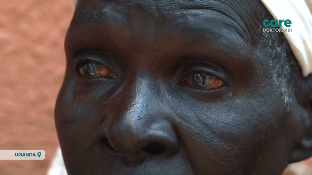 Uganda Yumbe'de İkinci Sağlık Kampımızı Tamamladık!