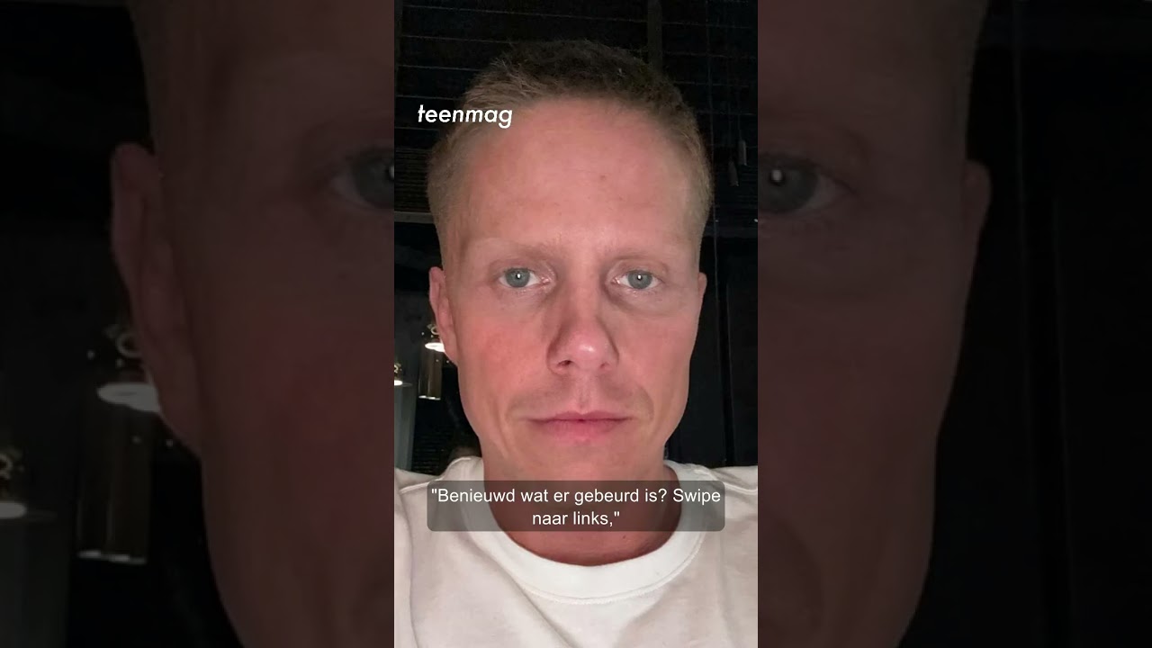 Andr&eacute; Hazes brandt gezicht tijdens show 😱