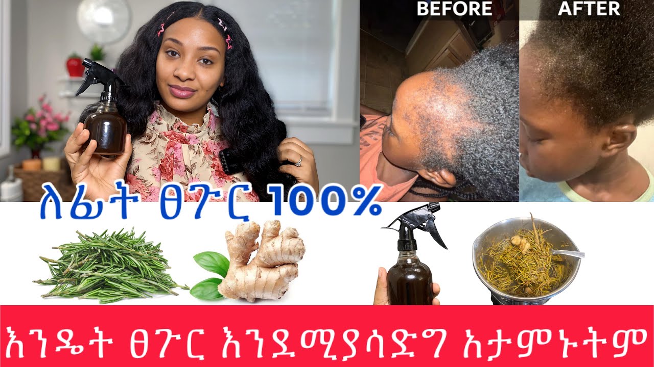 ⭐️ከፀጉር ማሳደግያ መድሀኒቱ minoxidil እኩል ይሰራል በየቀኑ ተጠቀሙት// best hair loss, hair growth homemade￼ remedy