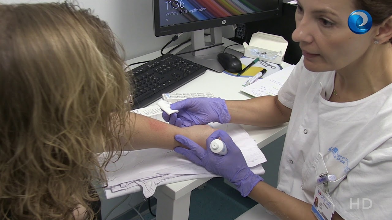 Dermatitis atópica grave: qué hacer frente a una enfermedad que no da tregua