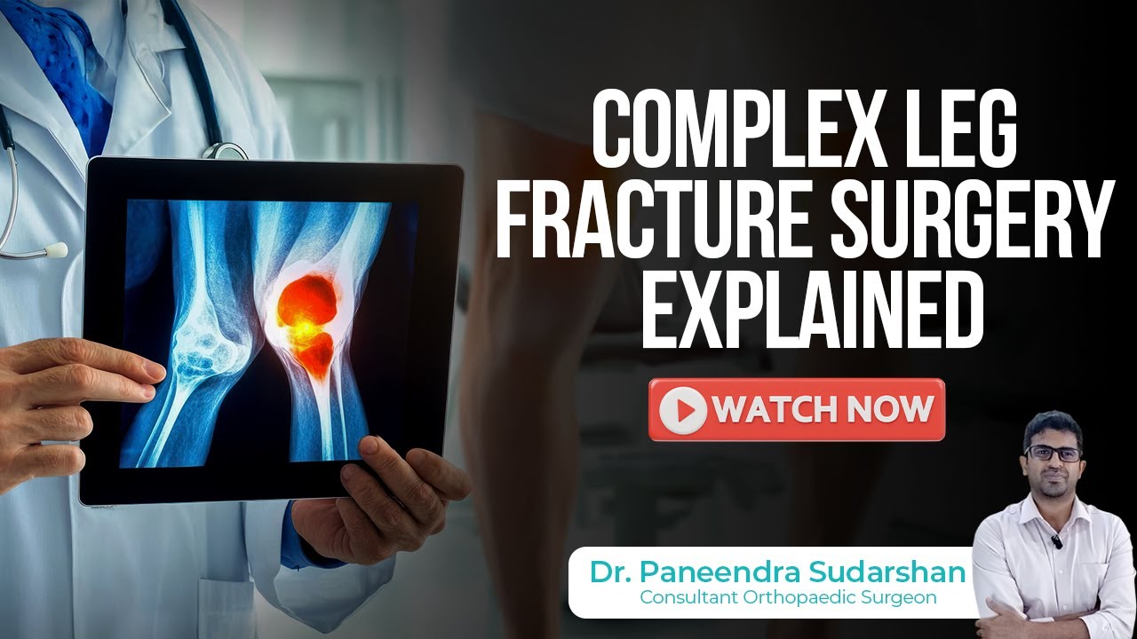 From Accident to Recovery | Open Tibia & Fibula Fracture Surgery Explained | Dr. Paneendra