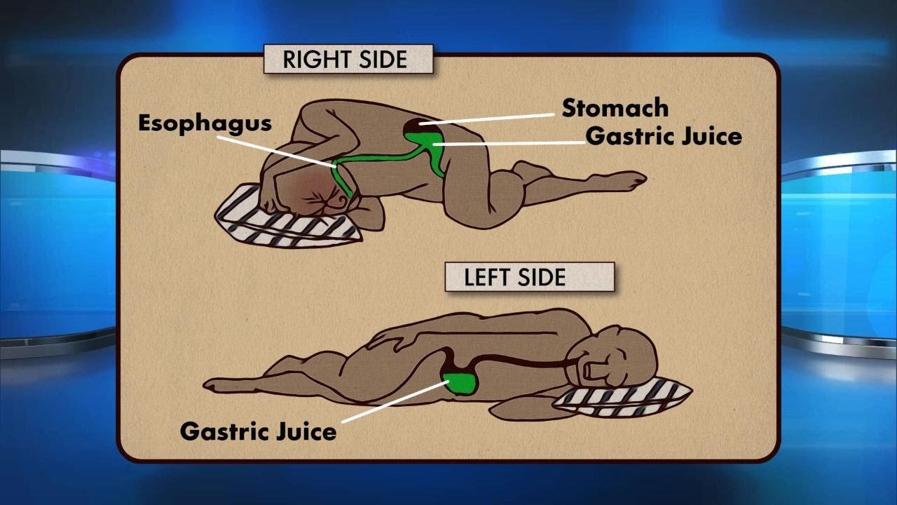 Can Sleeping on Your Left Side Benefit Your Health?