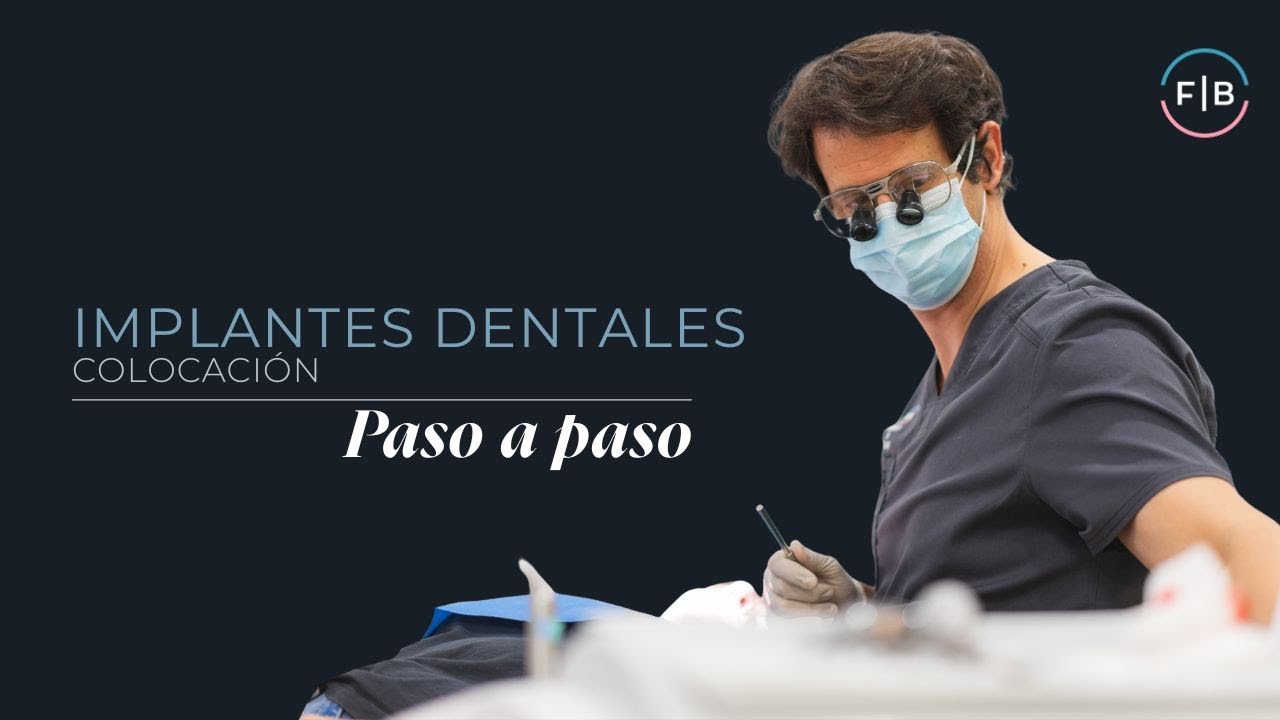 ¿Cómo se ponen los implantes dentales paso a paso? | Clínica Ferrus & Bratos