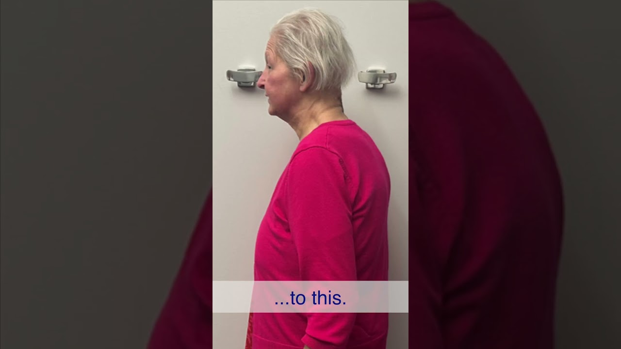 Preview: Janet's amazing transformation