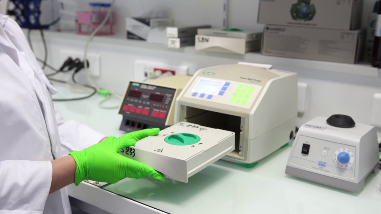 MOOC côté labo : Technique d’étude des protéines cellulaires : western blot : les méthodes