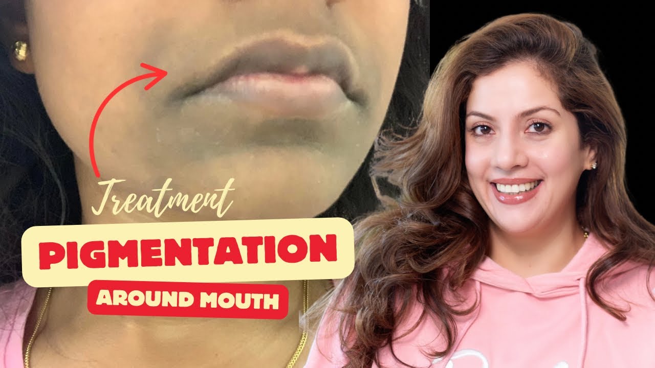 How to remove darkness around the mouth.
