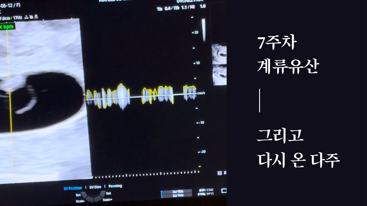 입덧 사라짐 7주차 계류유산 후 다시 찾아온 다주