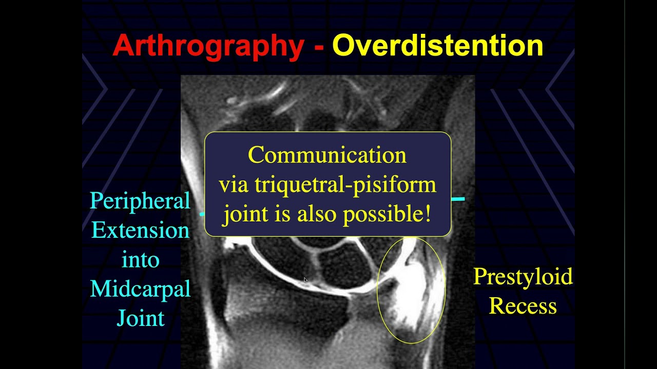 Wrist Congenital Trauma - Pt 1