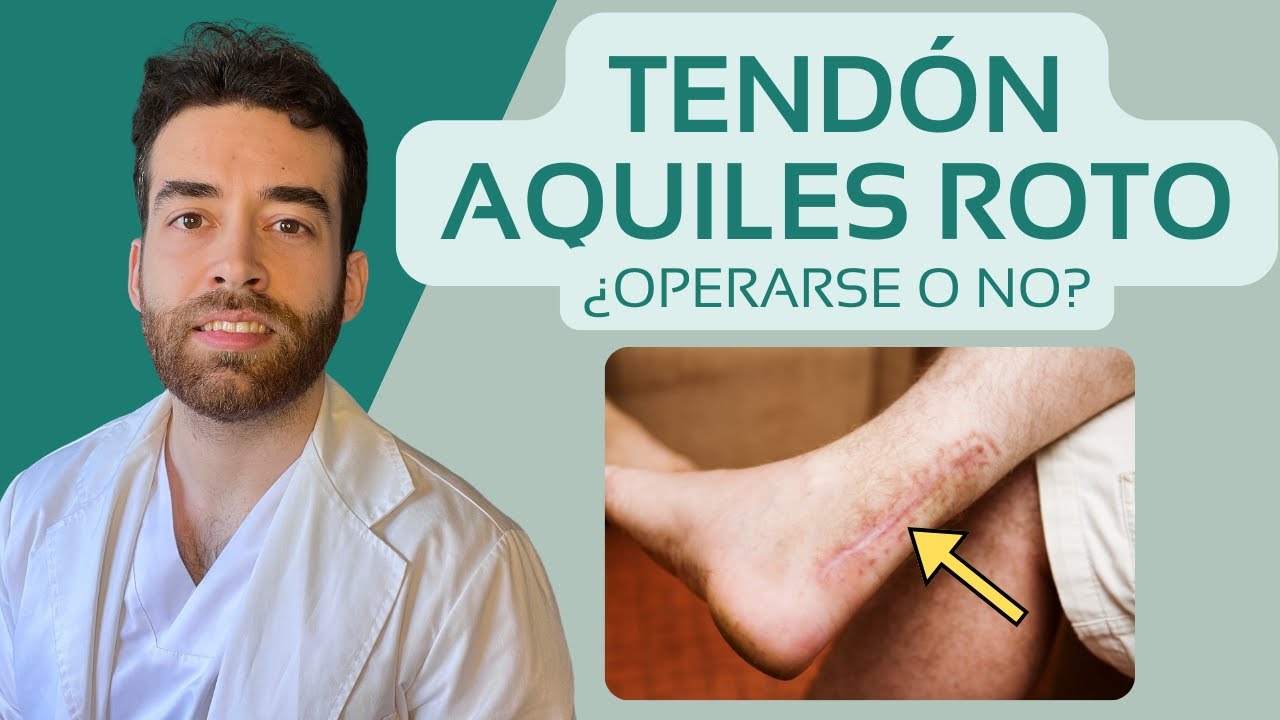 Rotura del tendón de Aquiles, ¿Operarse o no operarse?🤔