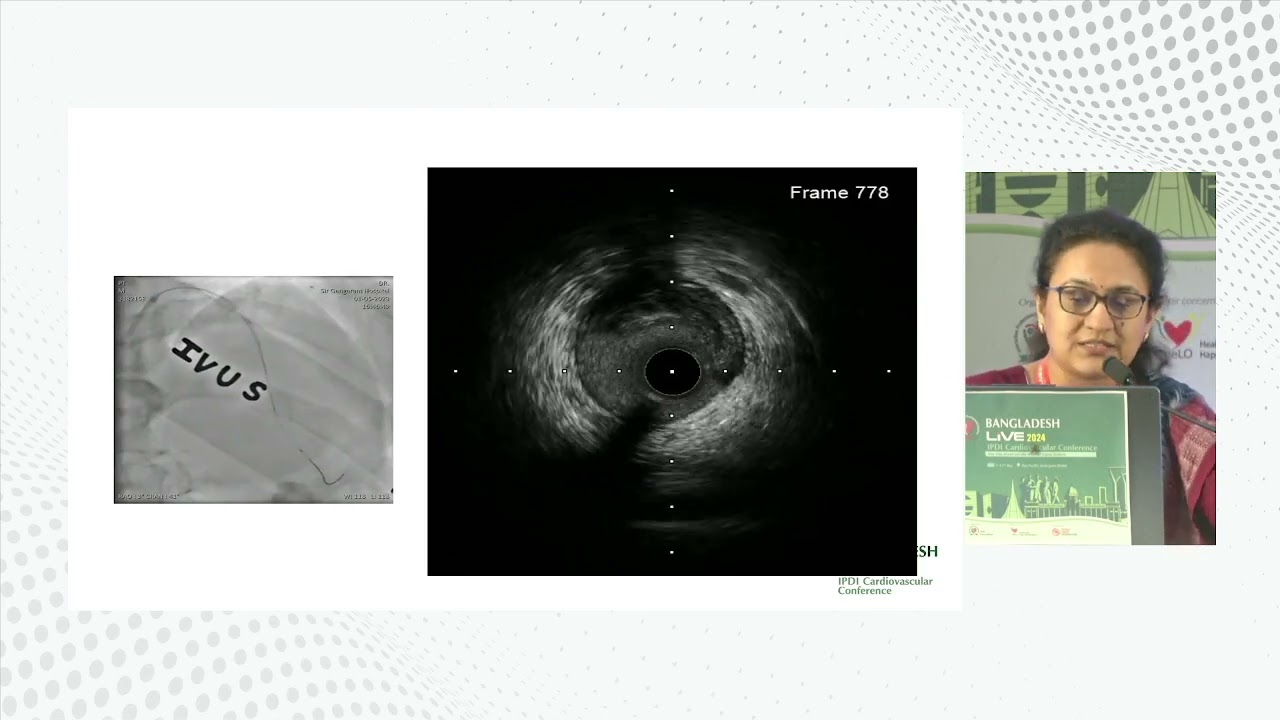 Managing Peri & Post PCI Complications: How Imaging helps? by Dr  Roopali Khanna