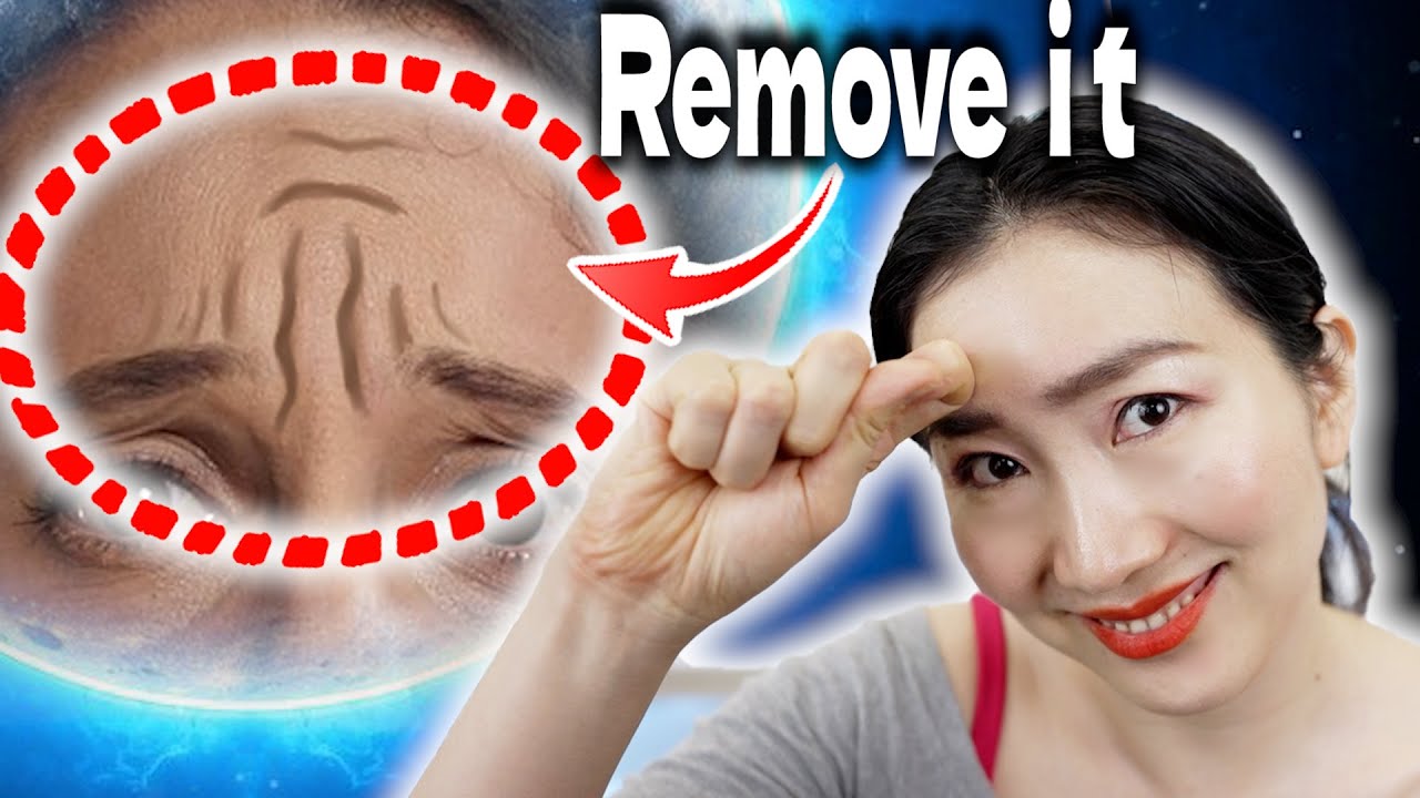 «Я отменил ботокс после того, как делал это в течение 2 недель!» Убрать морщины на лбу