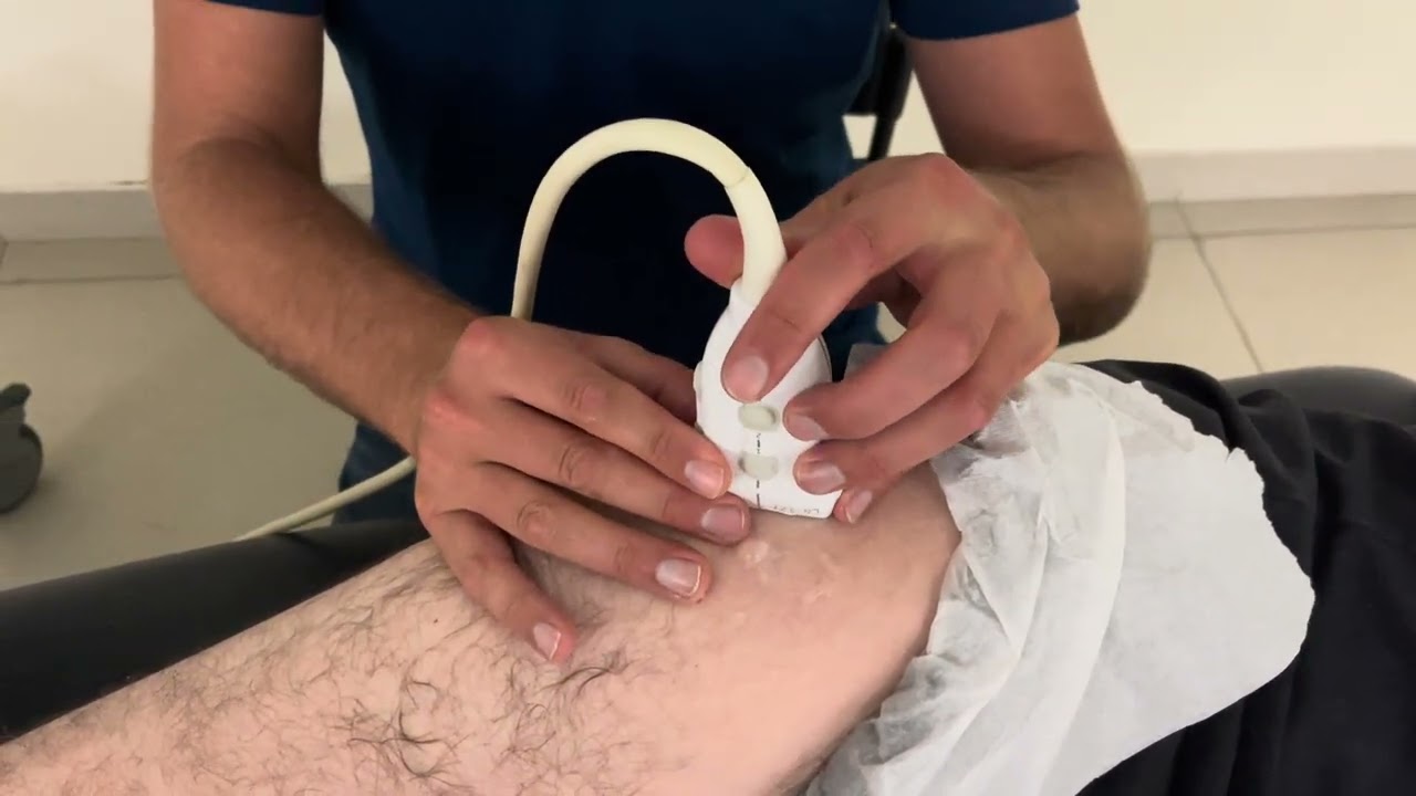MSK Ultrasound - Hip - Gluteus medius anterior tendon