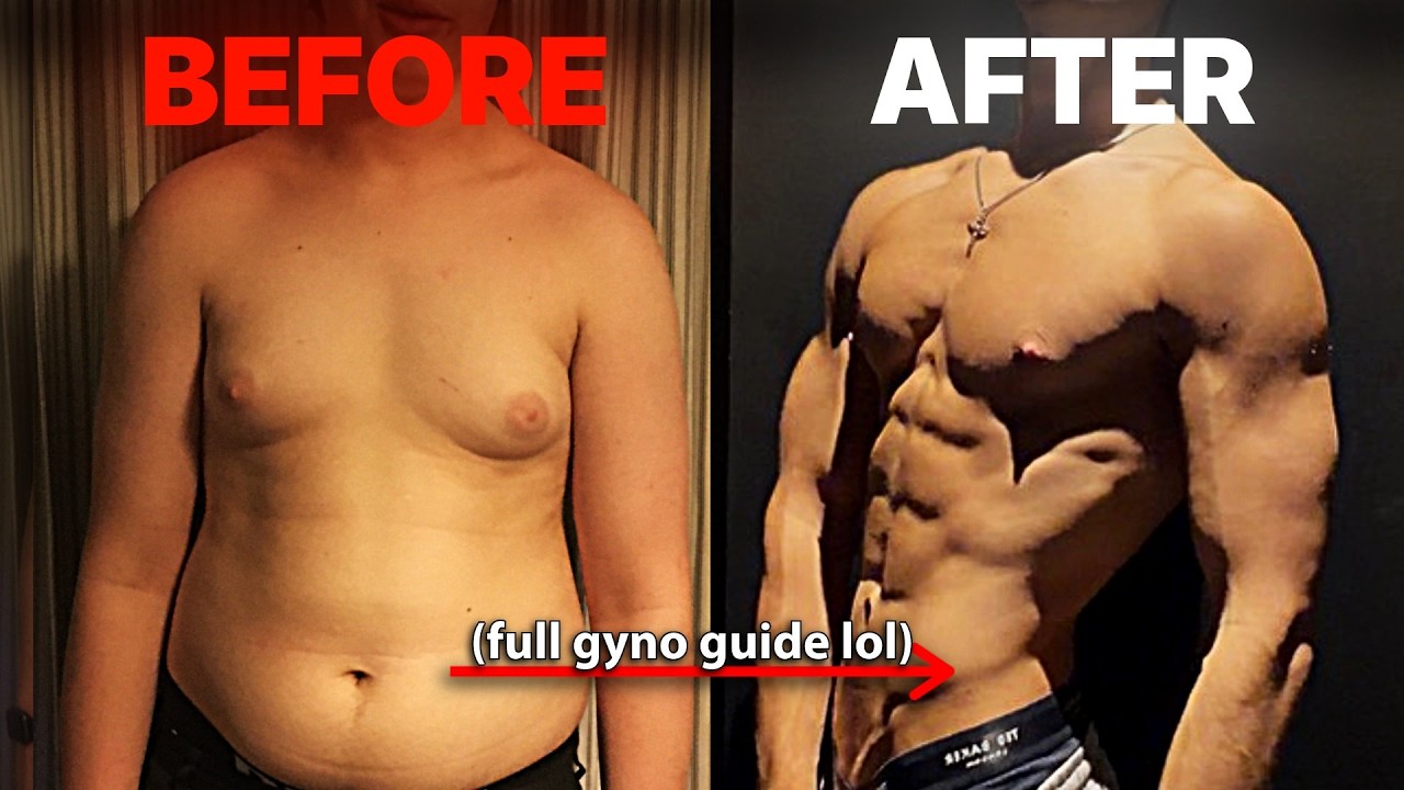 How I built an AESTHETIC CHEST even with GYNO (FULL GUIDE)
