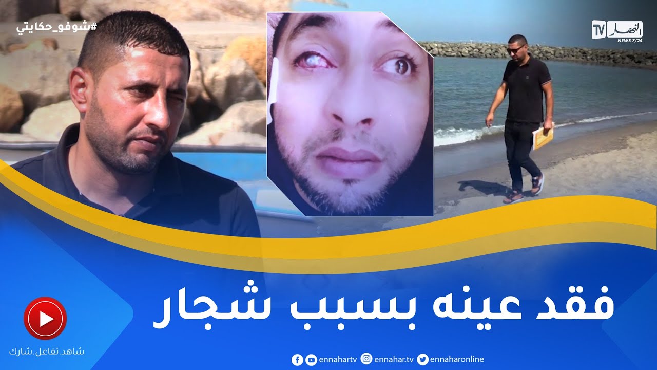 شوفو حكايتي:   بعد شجار عنيف شاب يفقد عينه اليسرى.. 
