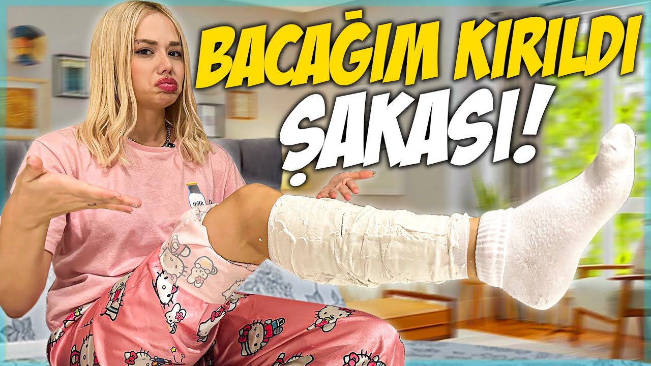 BACAĞIM KIRILDI ŞAKASI YAPTIM !? ( Öykü Çok Korktu ) @OykuKarta