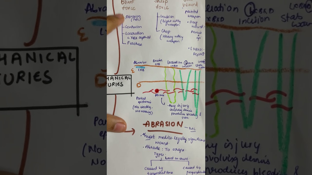 Mechanical injuries part 1 ! Classification of wounds :) Forensic medicine ✍️