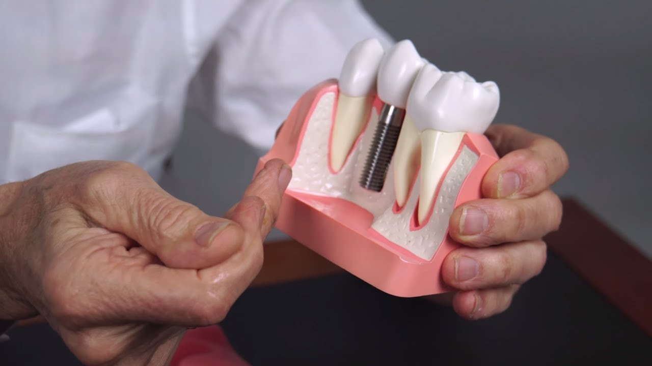 LAPIP: Treating Dental Implant Problems and Peri-Implantitis