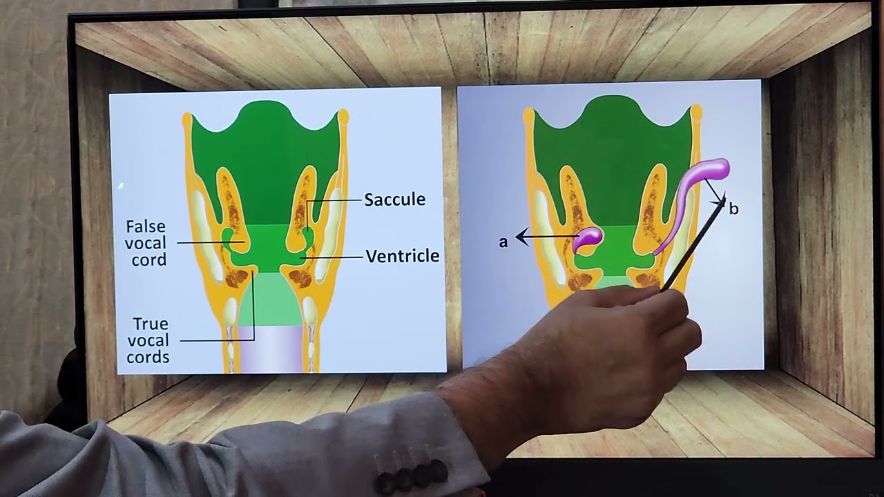 Laryngocele / English  / Patient teaching programme