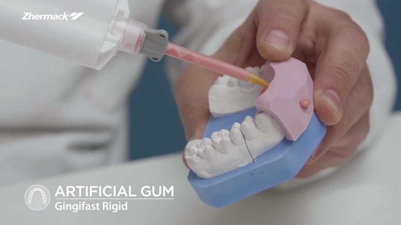 Dental Lab Procedure for Single Unit Crown - Pressable Ceramic Crown - Chapter 6: Artificial gum