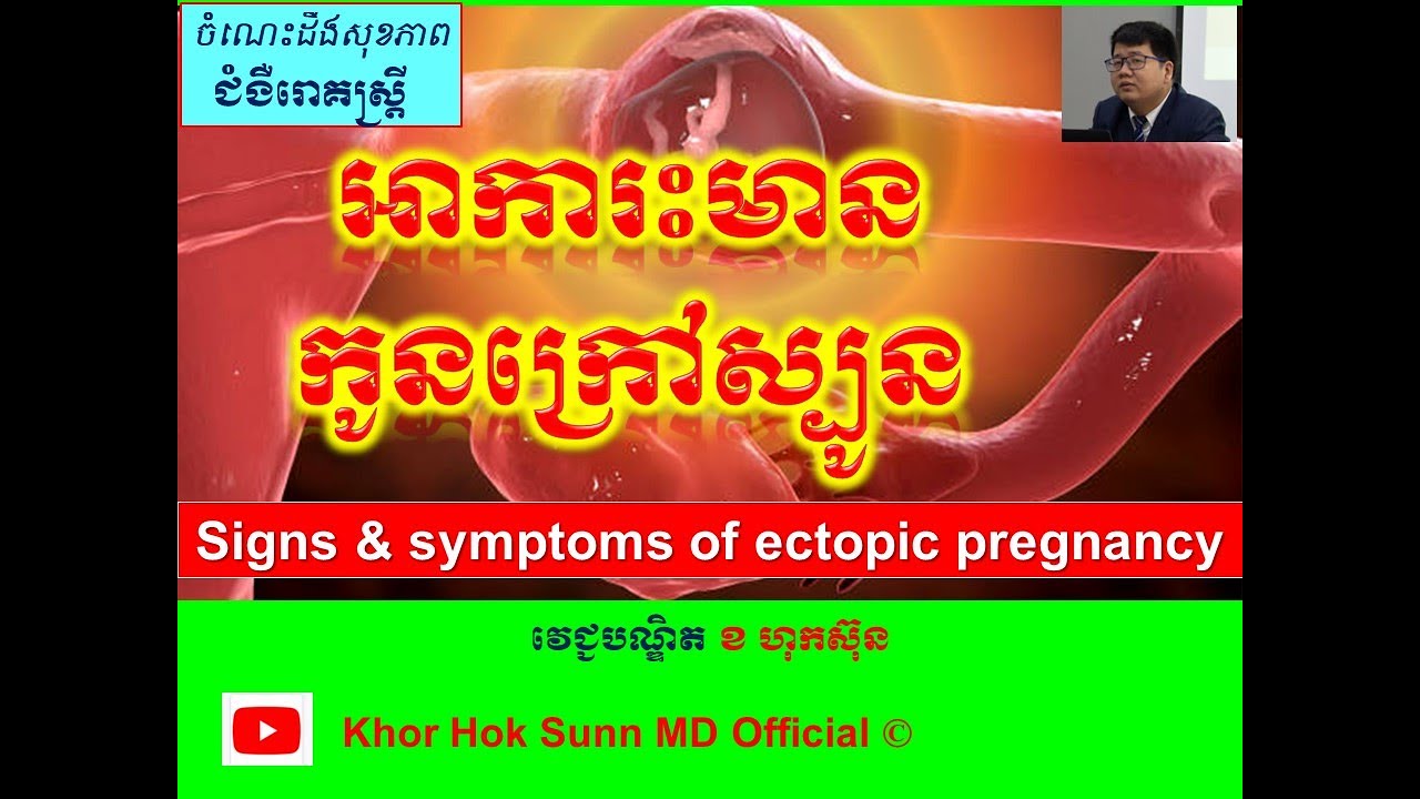 អាការះមានកូនក្រៅស្បូន l signs and symptoms of ectopic pregnancy l ចំណេះដឹងសុខភាព l Khor Hok Sunn MD