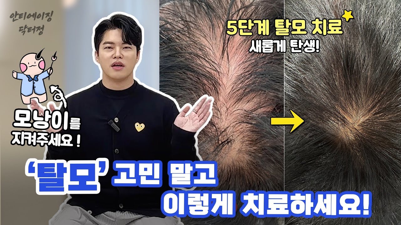 탈모 치료의 혁명! 줄기세포 미라젯 치료!!!