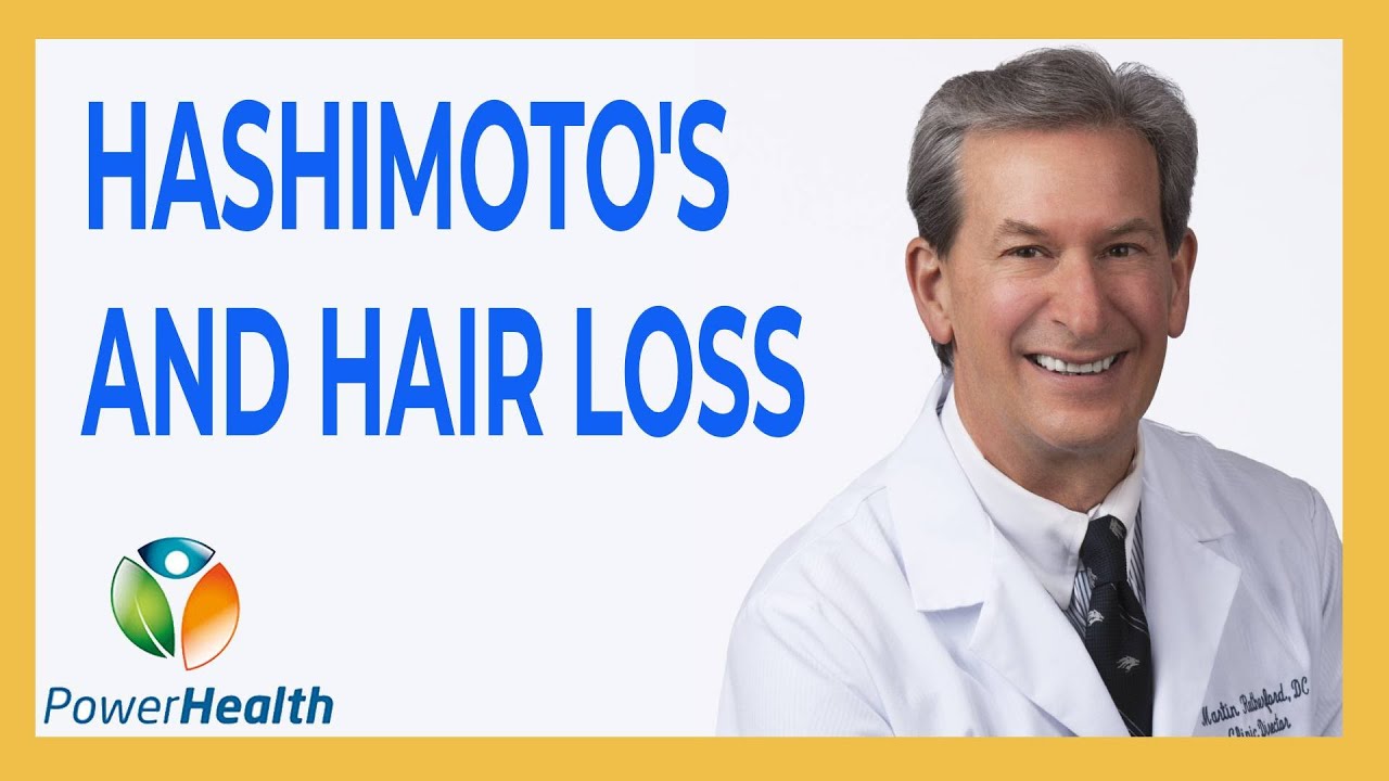 Hashimoto's and Hair Loss