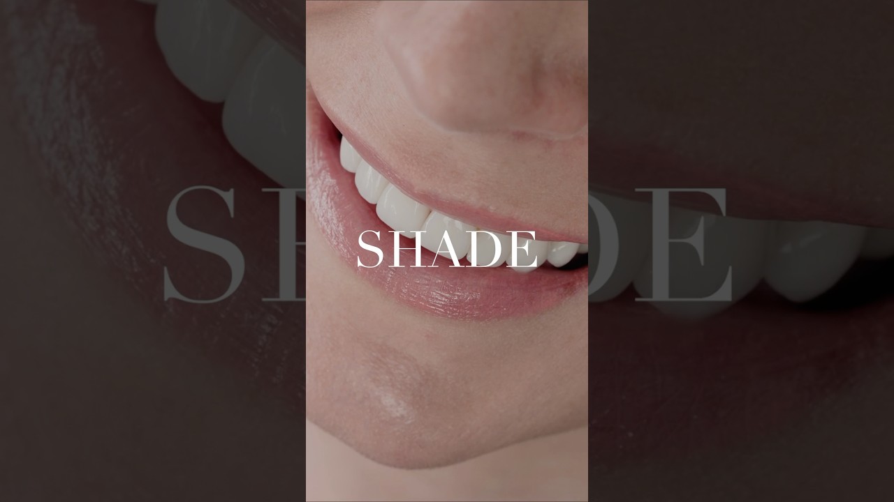 How We Help You Choose the Right Veneer Shade | Dr. Alex Shore
