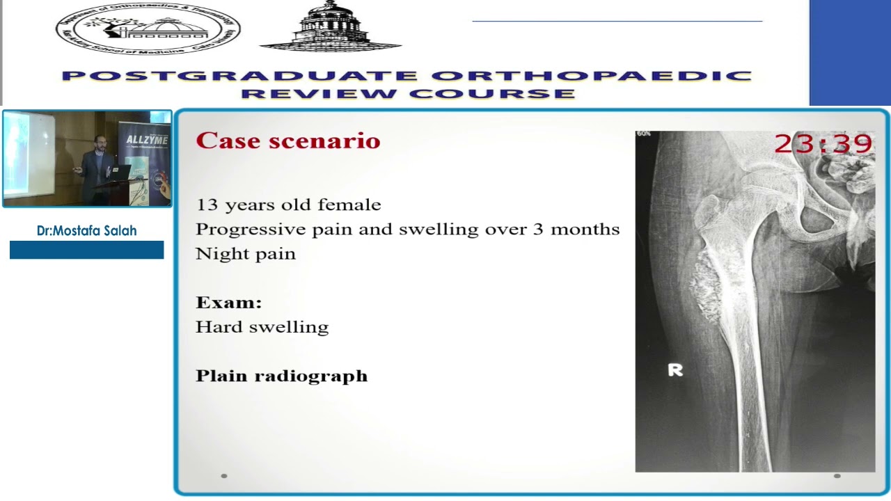 4 Diagnosis and staging of Malignant Bone Tumours   Mostafa Salah