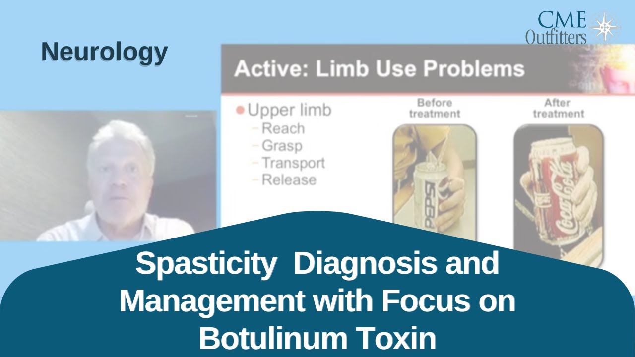 Spasticity Diagnosis and Management with Focus on Botulinum Toxin