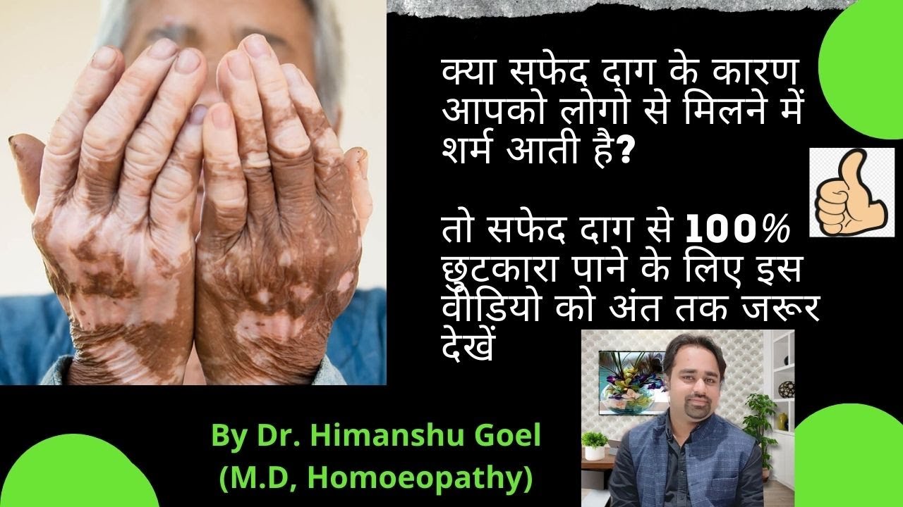 vitiligo causes and treatment | सफ़ेद दाग से छुटकारा पाने का होमियोपैथी इलाज |by dr. himanshu Goel