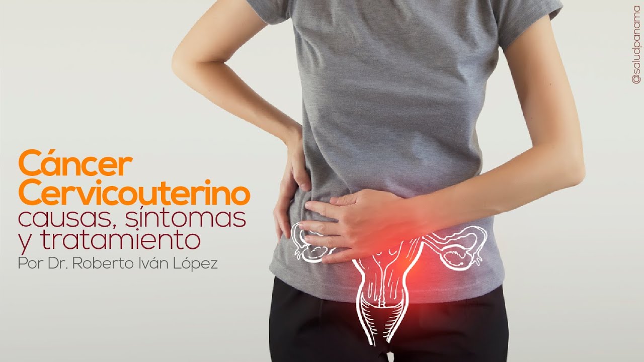C&aacute;ncer Cervicouterino: causas, s&iacute;ntomas y tratamiento