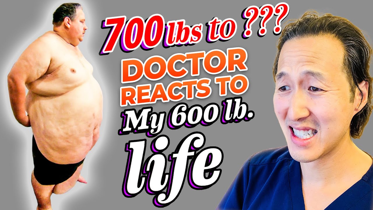 Plastic Surgeon Reacts to MY 600 LB LIFE! How Much Can He Lose?