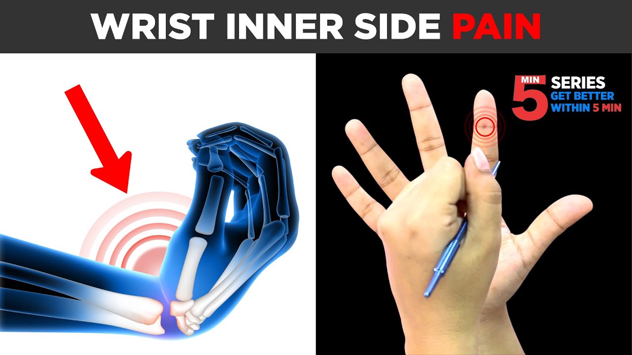 SUJOK TREATMENT FOR Wrist Left Inner Side Pain💪🏻😖🔥(ON RIGHT HAND)